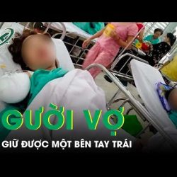 1️⃣【 Vụ Chồng Cuồng Ghen Ở Đồng Nai: Người Vợ Đã Qua Cơn Nguy Kịch, Chỉ Giữ Được Một Bên Tay Trái